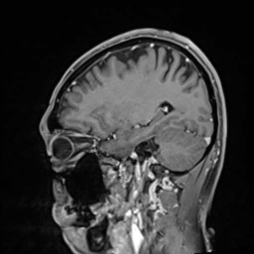 Click on the Serie image to view the images of VILLANUEVA, WILLIAM A.